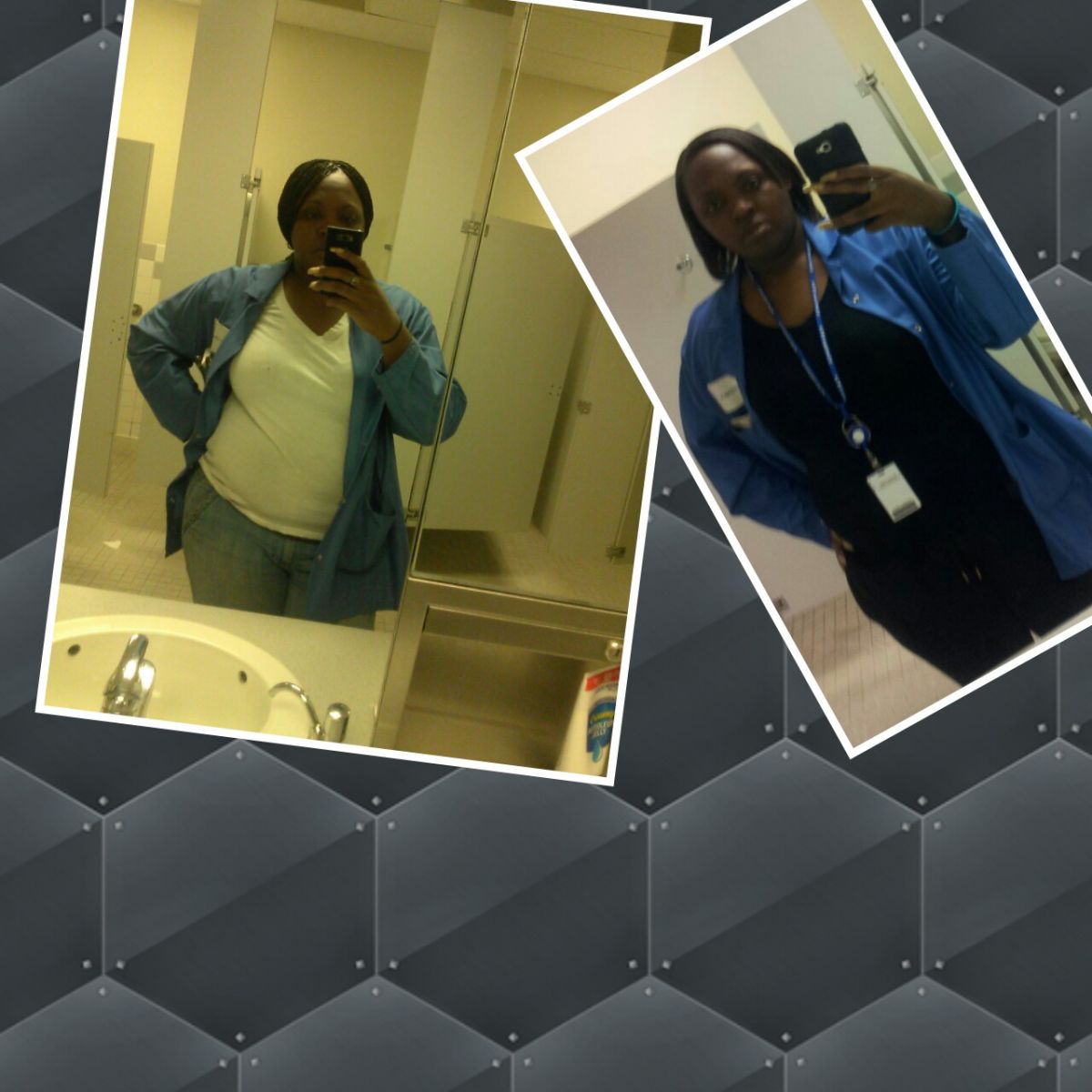 preop and first stages