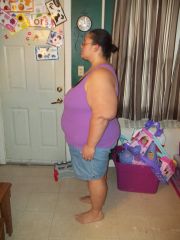 February 2014 359lbs 3 weeks post Op 1