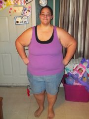 February 2014 359lbs 3 weeks post Op 2