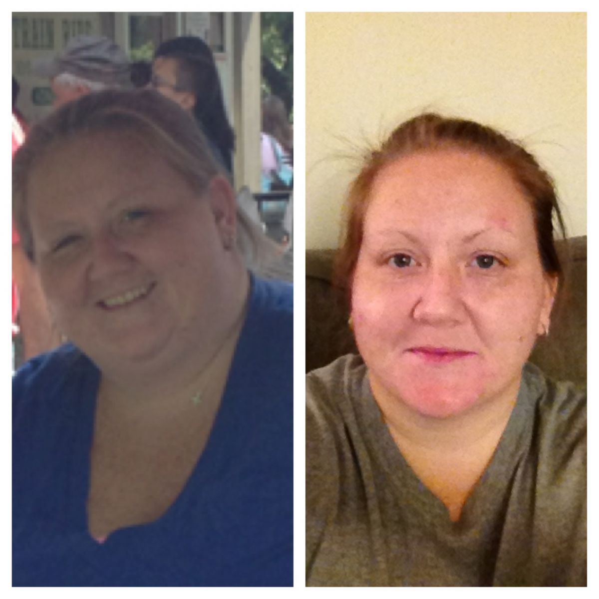 Progress pics