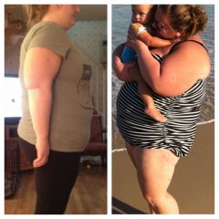 Pre-op 286 & 1 month post op 250
