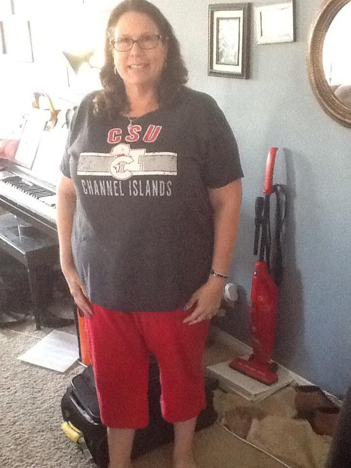 Before gastric sleeve
