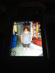 Deb Pre Op 2014 003