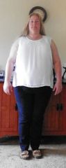 2 Months pre-op