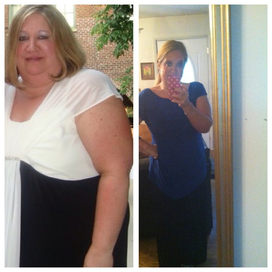 before and after