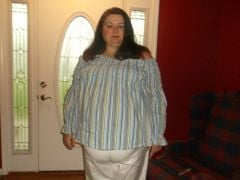 Pre-op