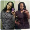 4 months after gastric sleeve