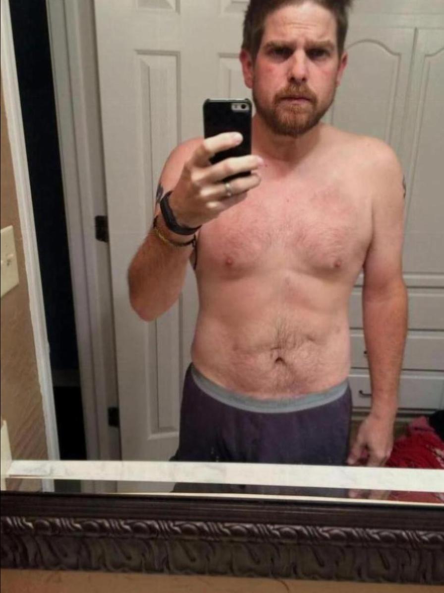 Matt Before and After