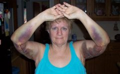 arms 3
