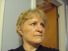 facelift after just two weeks