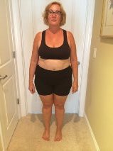 "Before" Pics, 5 days before surgery