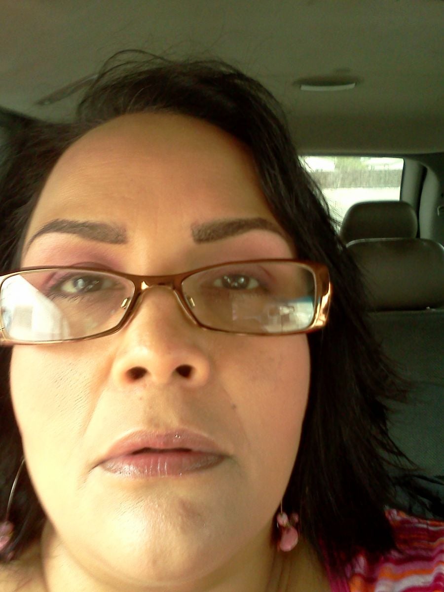 Me before bariatric 