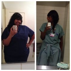 Comparison- Oct 4th 2013 and 9 months postop