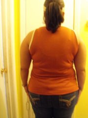 back day of surgery