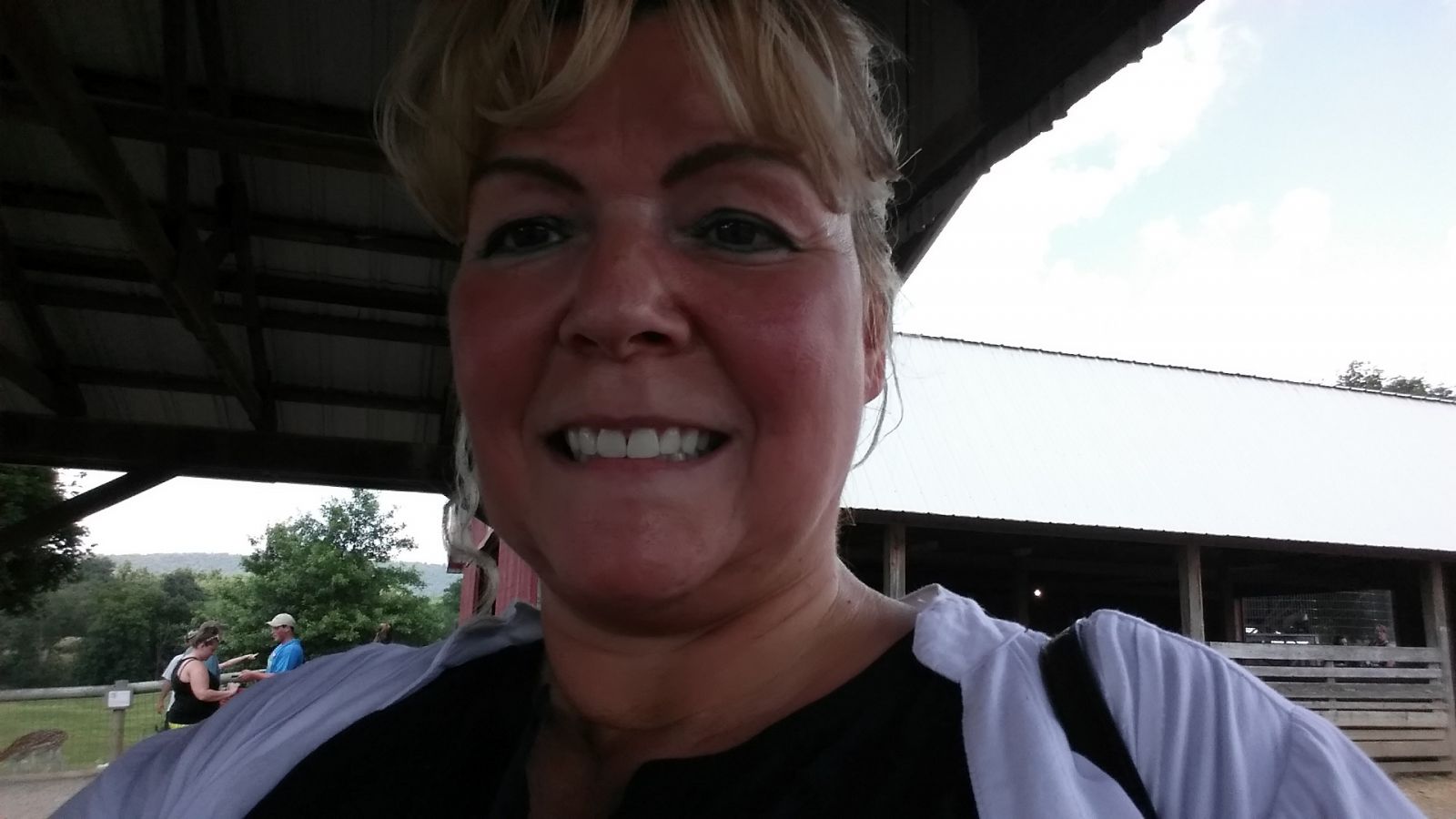 Before Surgery Photo's