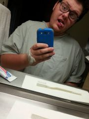 1 day post op 11/21/14