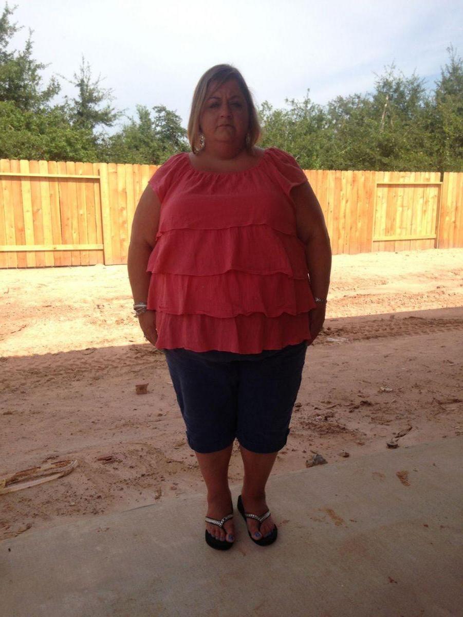 Before Surgery