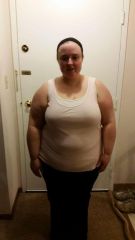 The night before surgery!
