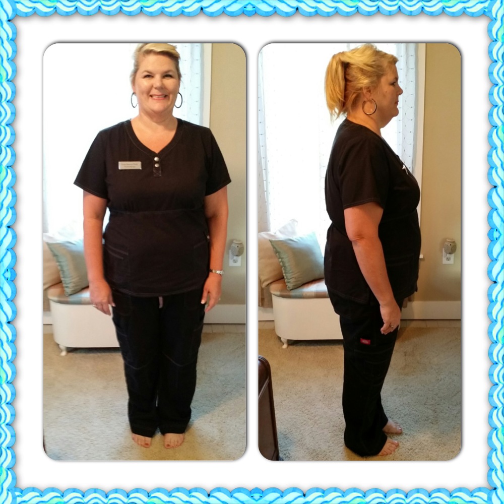 Two Months Postop