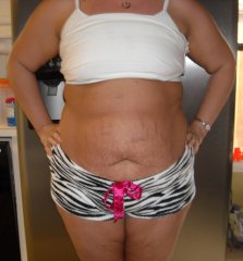 scars on day 15