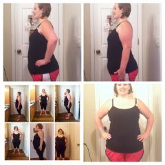 6 Months post op, and before pic