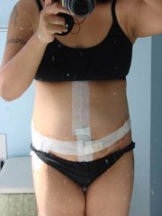 10 days post front