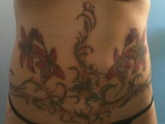 The final stage - the tattoo to camouflage the body lift scars