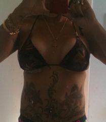 Breast Augmentation 28 Oct 2010 - 3 days post op