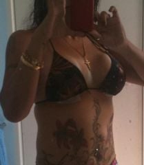 Breast Augmentation 28 Oct 2010 - 3 days post op