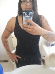 2 days post liposuction - some swelling still evident