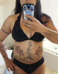 pre-liposuction