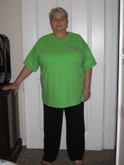 Me before surgery 10/1/2014