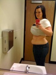 16 days post op and 30 lbs lost