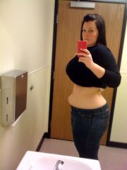 27 days post op!! 32 lbs lost