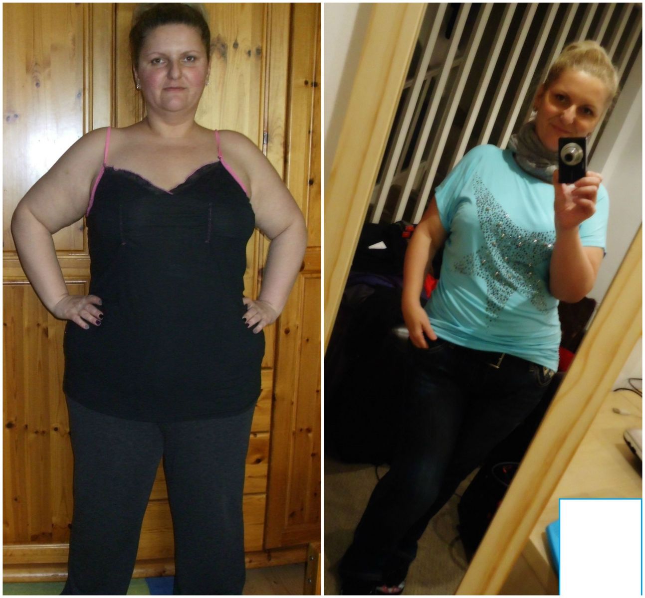 6 months post-op