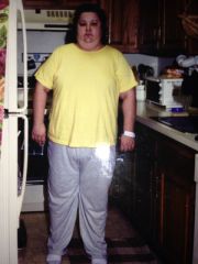 My Bariatric Life before weight loss and plastic surgeries