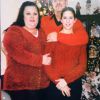 My Bariatric Life before weight loss and plastic surgeries