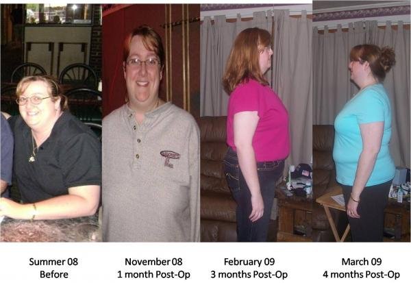 Photos