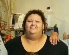 Before Gastric Bypass