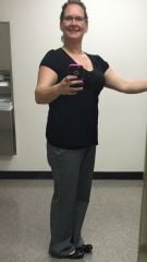 me 12 weeks post op.jpg
