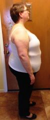June Pre Op side