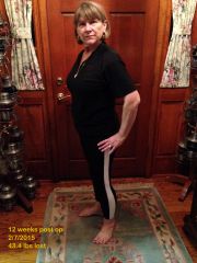 12 Weeks post Op 2 Feb 7, 2015