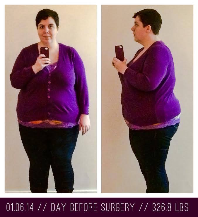 Body Shot Comparisons