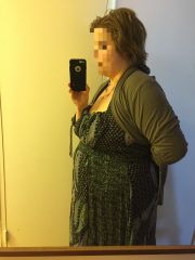 3/6/2015 pre-op VSG surgery 3