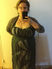 3/6/2015 pre-op VSG surgery 2
