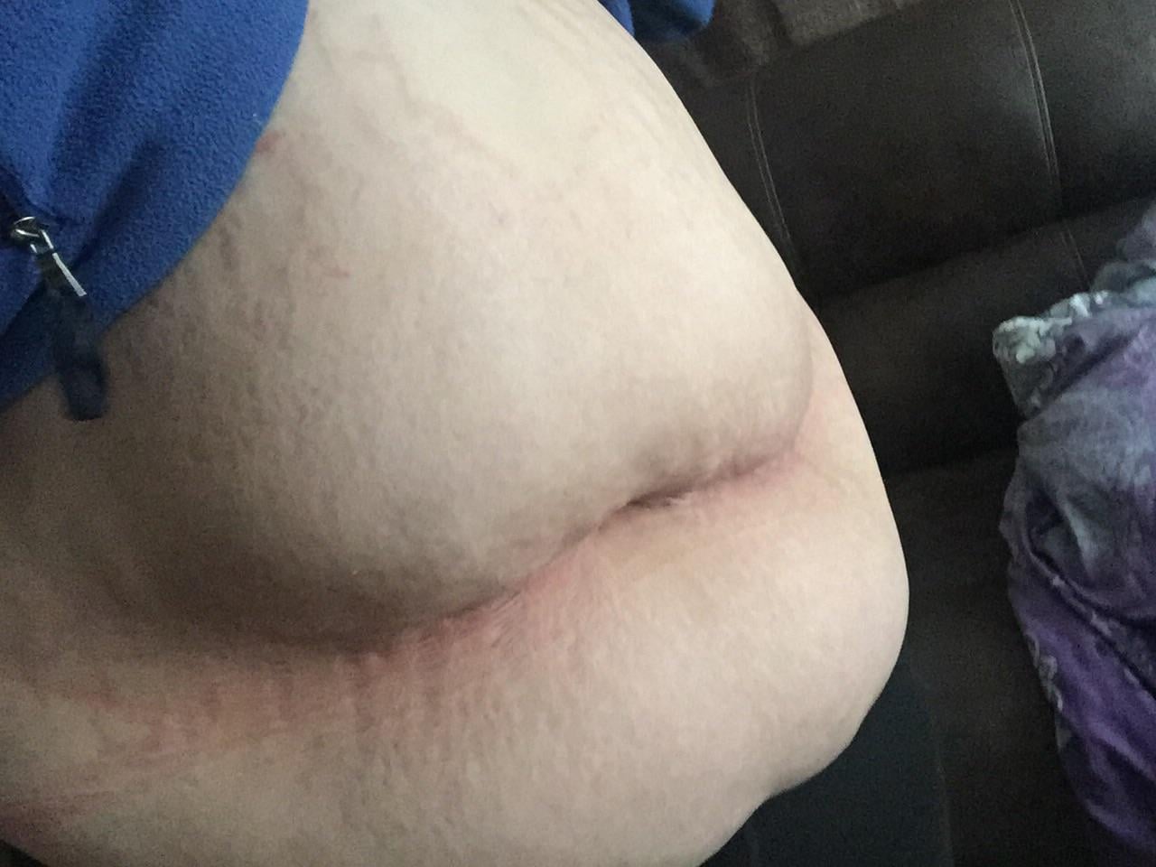 Before surgery