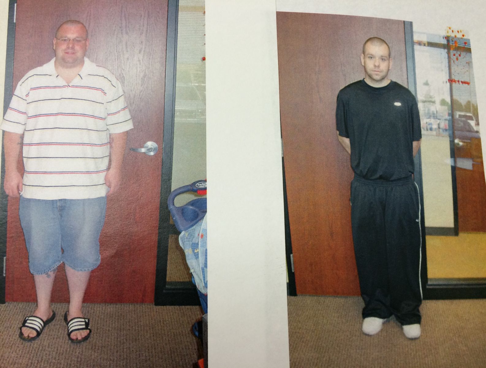 Pre-Op and Post-Op