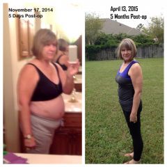 5 month side By side