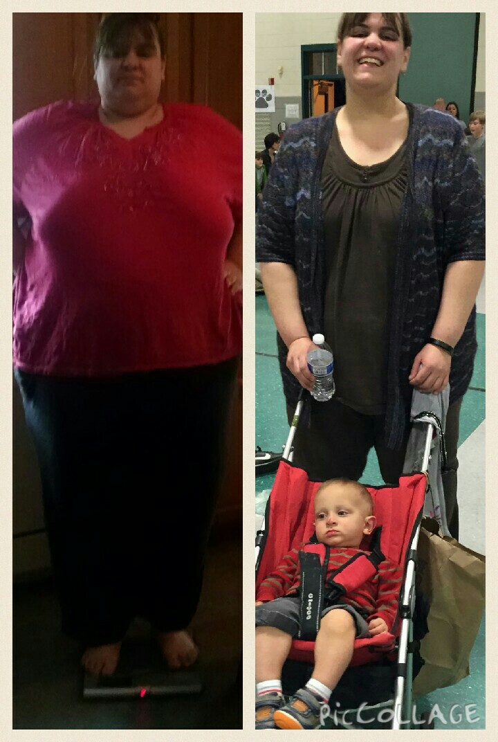 Before and After