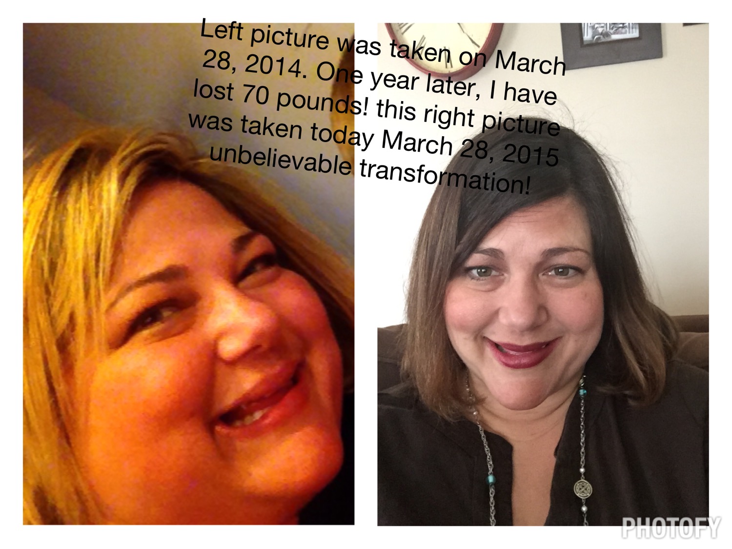 Before and after surgery